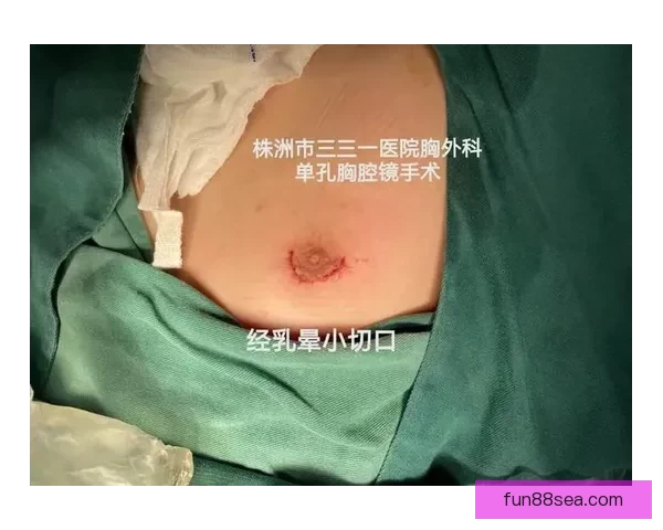 坎宁安气胸康复持续推进 活塞计划一周后复查评估